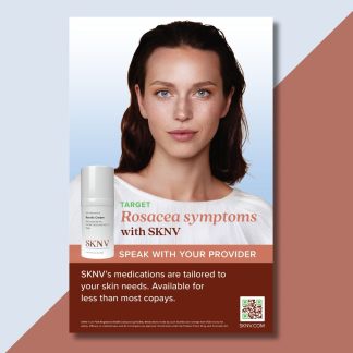 Rosacea Wall Cling